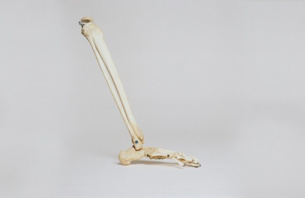 bones
